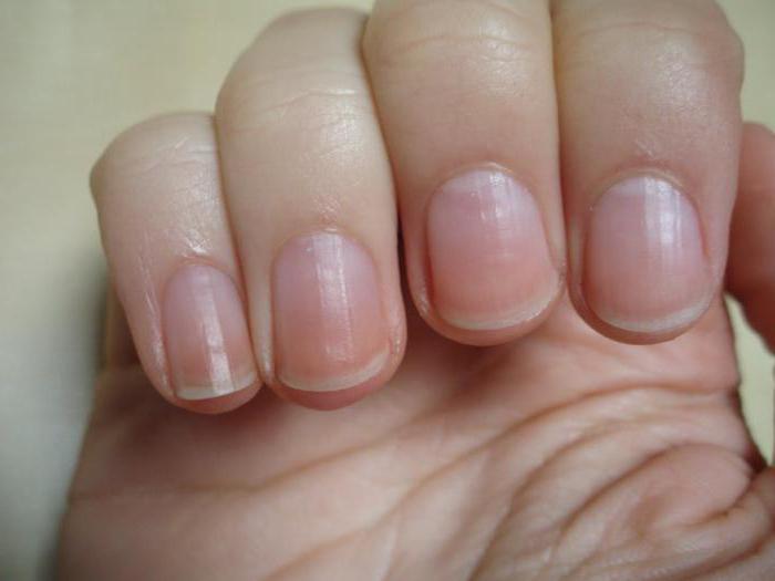 why nails grow